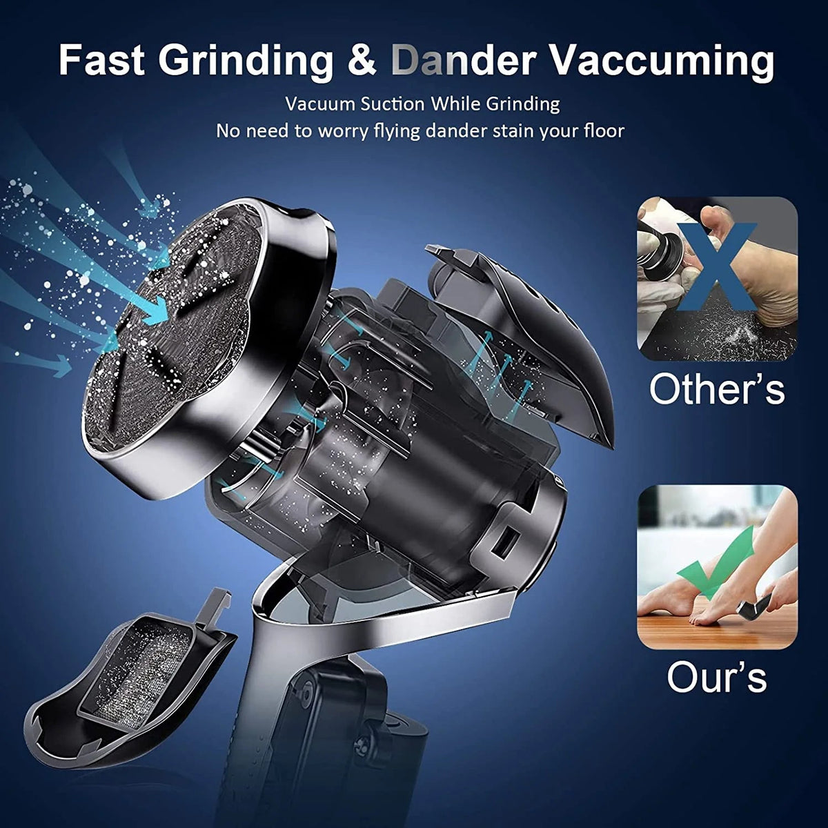 NNL Marketplace - Electric Callus Remover Kit