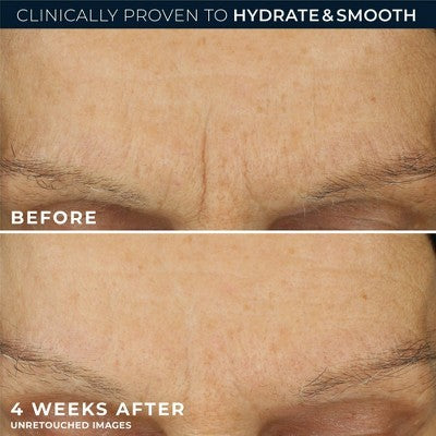 RoC Retinol Correxion Line Smoothing Max Hydration Cream 1.7oz - Missing Box