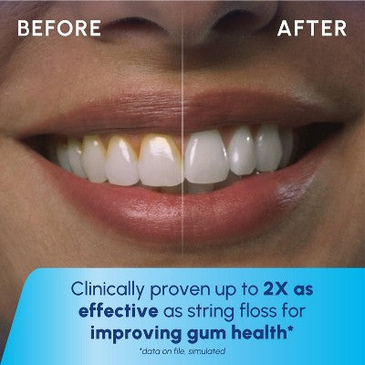 Waterpik Cordless Enhance Water Flosser - Imperfect Box