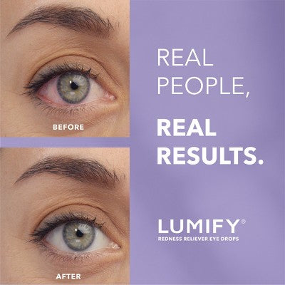 Lumify Eye Drops for Redness Relief 2.5ml - Missing Box