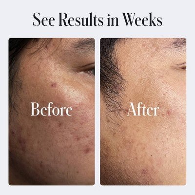 Geologie Clear System Skin Repair Moisturizer 0.2% Retinol 2 fl oz - Missing Box