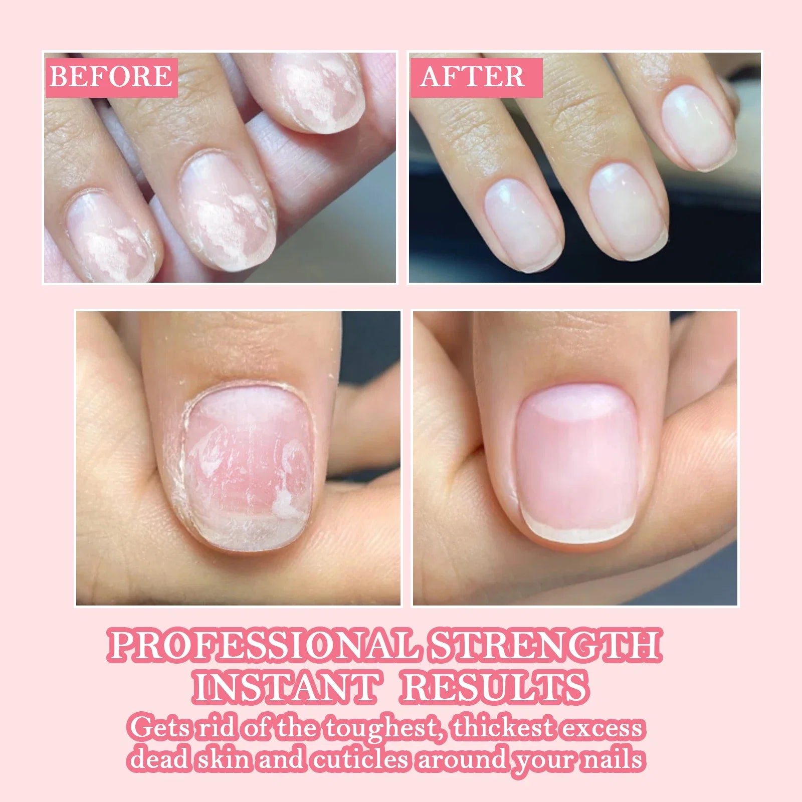 NNL Marketplace - Calcium Nail Strengthener 20ml