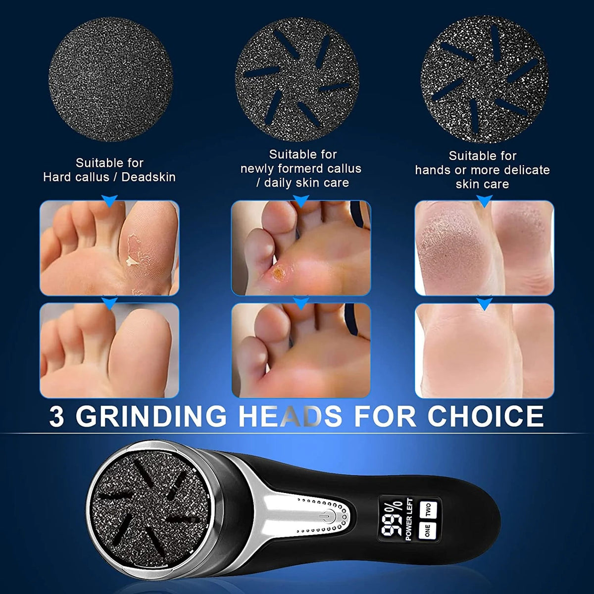 NNL Marketplace - Electric Callus Remover Kit
